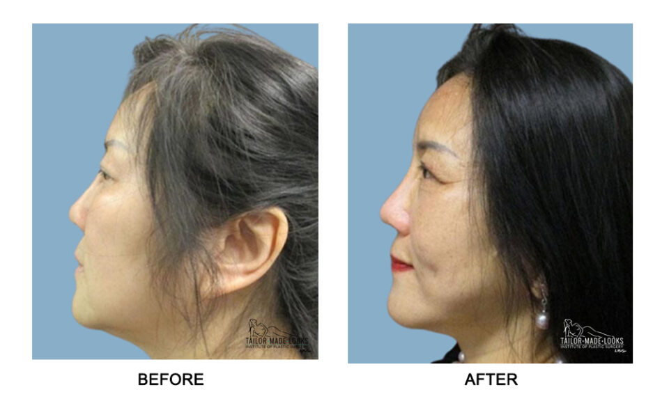 Beauty Surgery Pattern View Patient Details | Tailor Made Looks Institute of Plastic Surgery